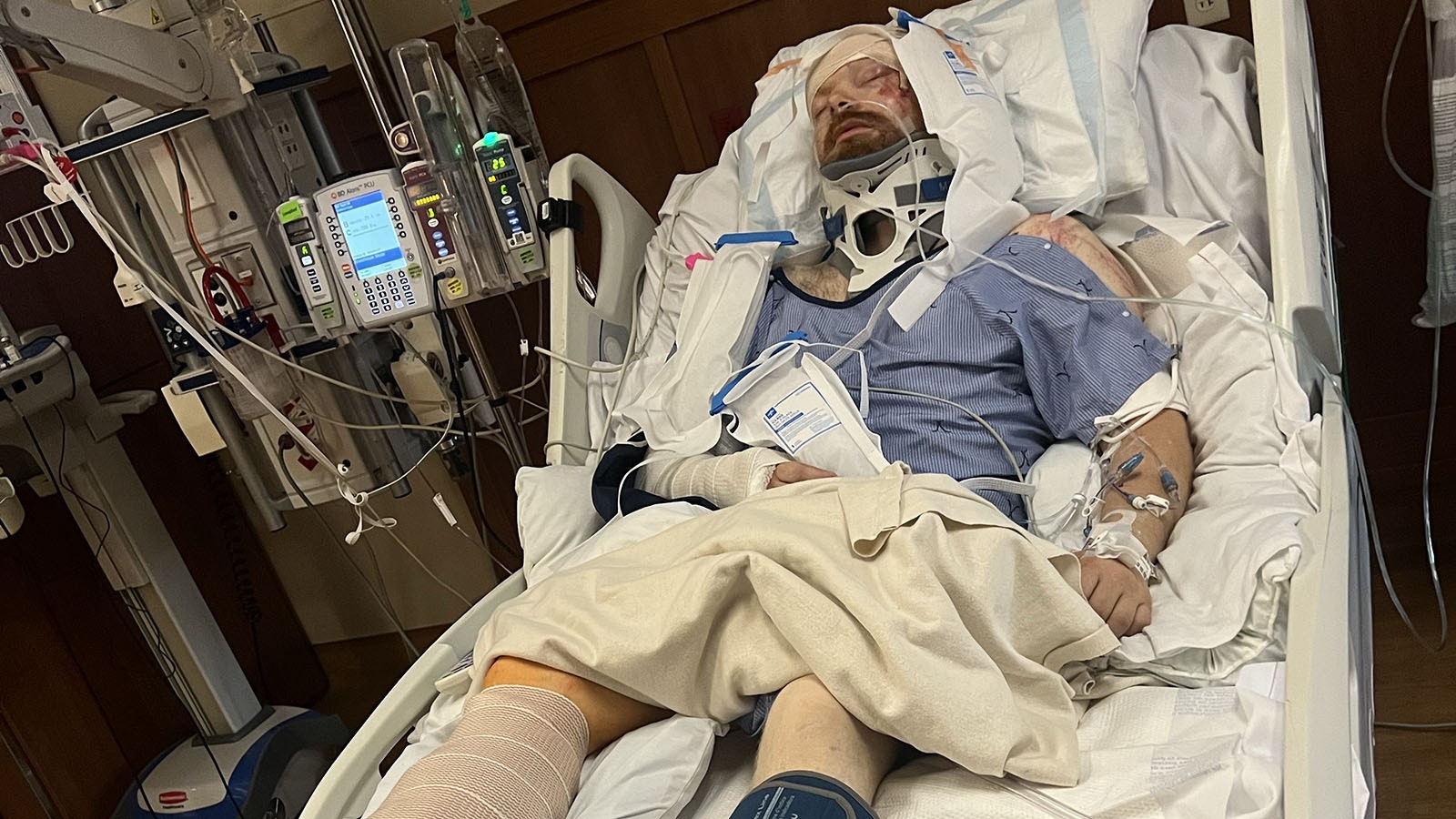 After suffering numerous serious injures in a side-by-side rollover crash in Park County this month, Skyler Peterson faces a long road to recovery.