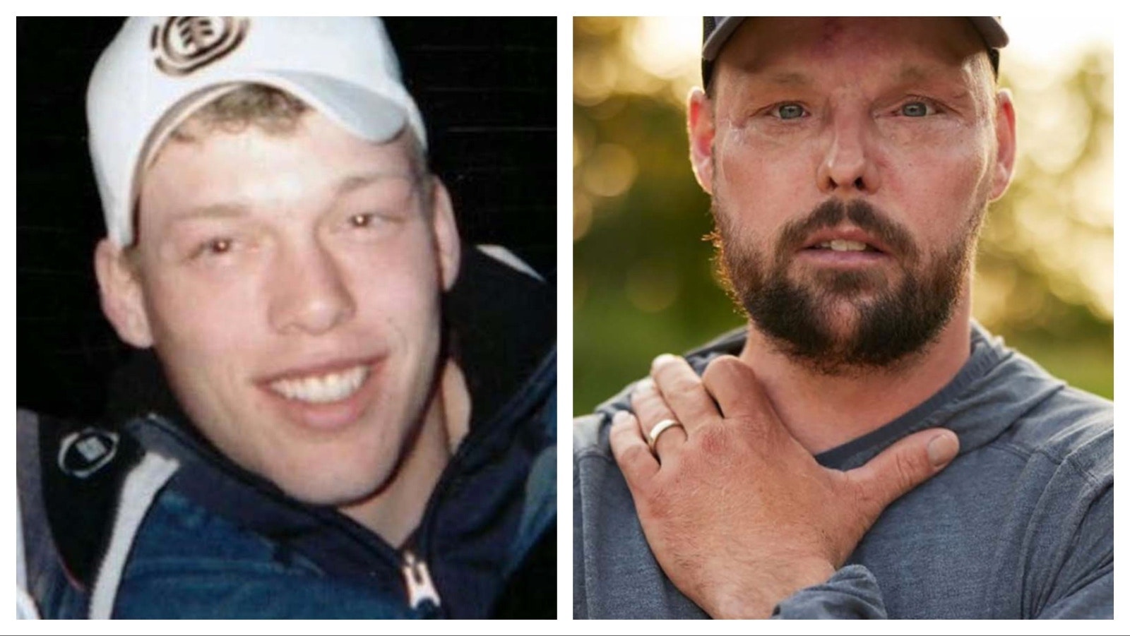 Andy Sandness as a young man in Wyoming, left, and after his successful 2016 face transplant surgery, right.