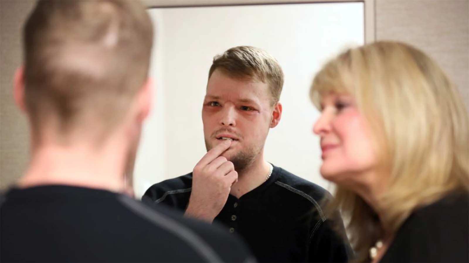 Dr. Mardini’s, his team and the life-changing aftermath of Sandness’ face transplant surgery. During his stay at Mayo, Sandness said security personnel protected him from unwanted media attention.
