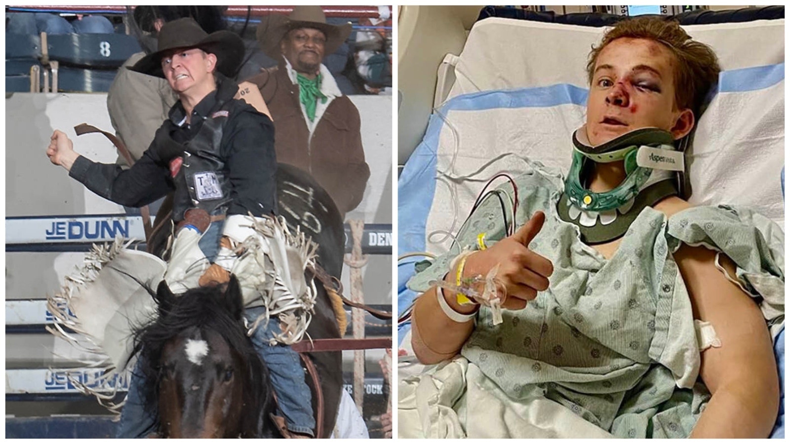 Left, Austin Broderson, a 19-year-old Casper College student, comes out of the chute on Jack Dupp during a ride in the National Western Stock Show Rodeo in Denver on Jan. 15, 2023. After finishing his 8-second ride, Broderson's rigging slipped and he was drug and trampled by the horse. He survived and is recovering in a Denver hospital. Right, Broderson gives a thumbs up from a hospital bed in Denver