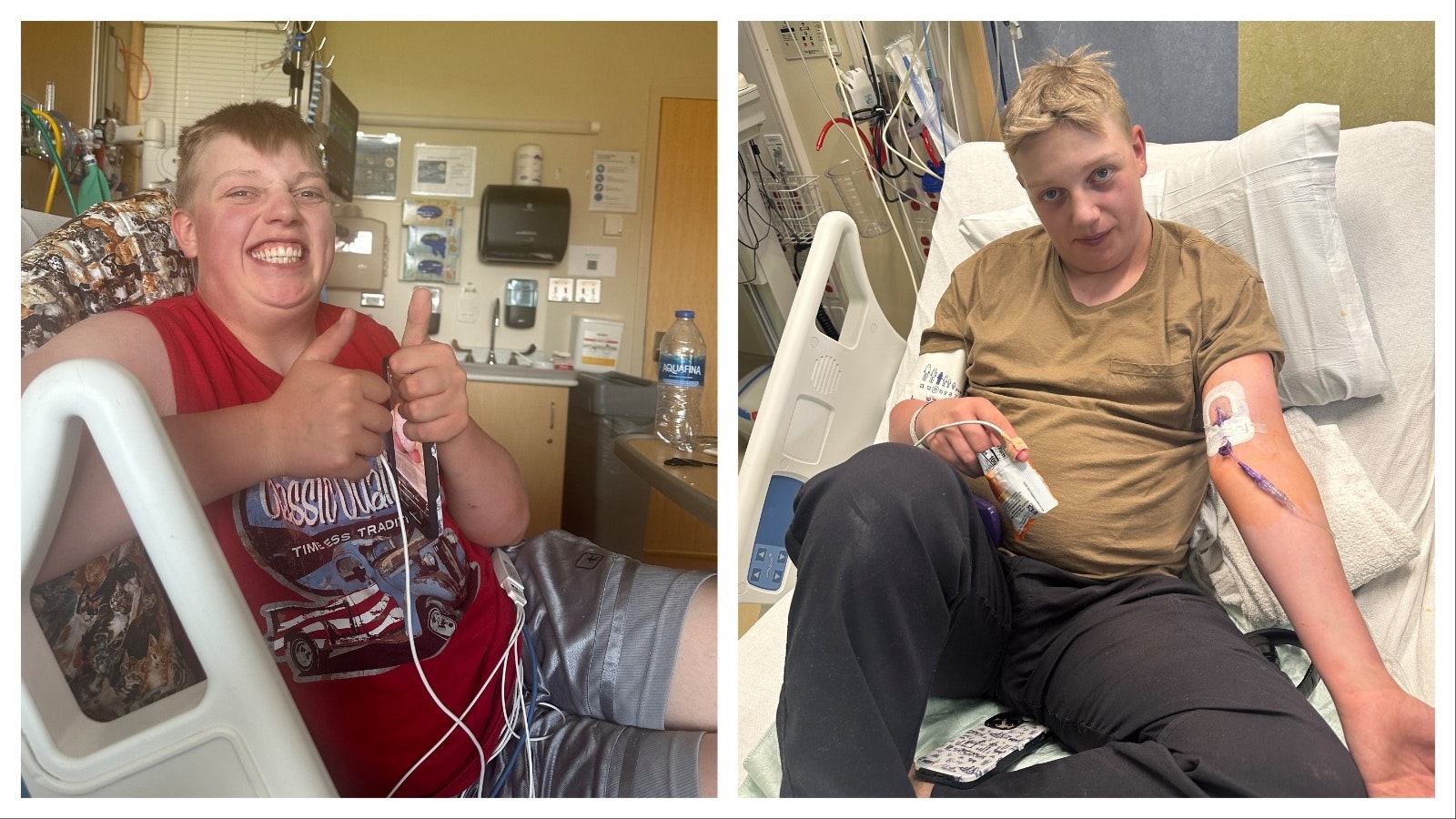 A series of photos showing Ayden Skillman's journey to get a new hart. At left, the day he foundout a heart was available. Right, the day he was admitted, July 22, to start on medication. Scroll to see the series.