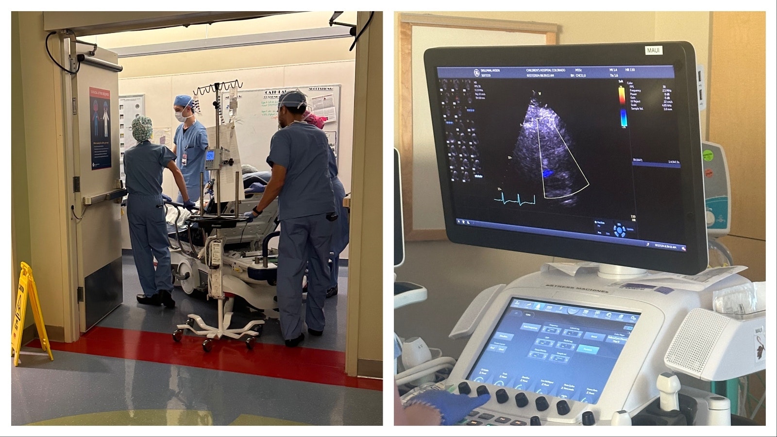 Ayden Skillman is wheeled into the operating room, left. The operation began at 9:30 a.m. and ended at 10:30 p.m. At right is an ultrasound showing his new heart for the first time.