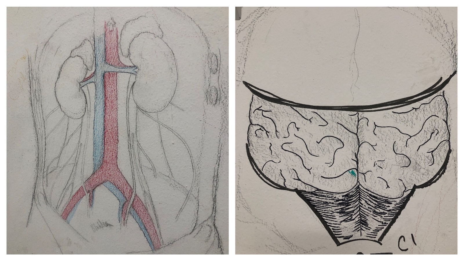 Students working in the Casper College cadaver lab are encouraged to illustrate their interpretation and perception of what they see.