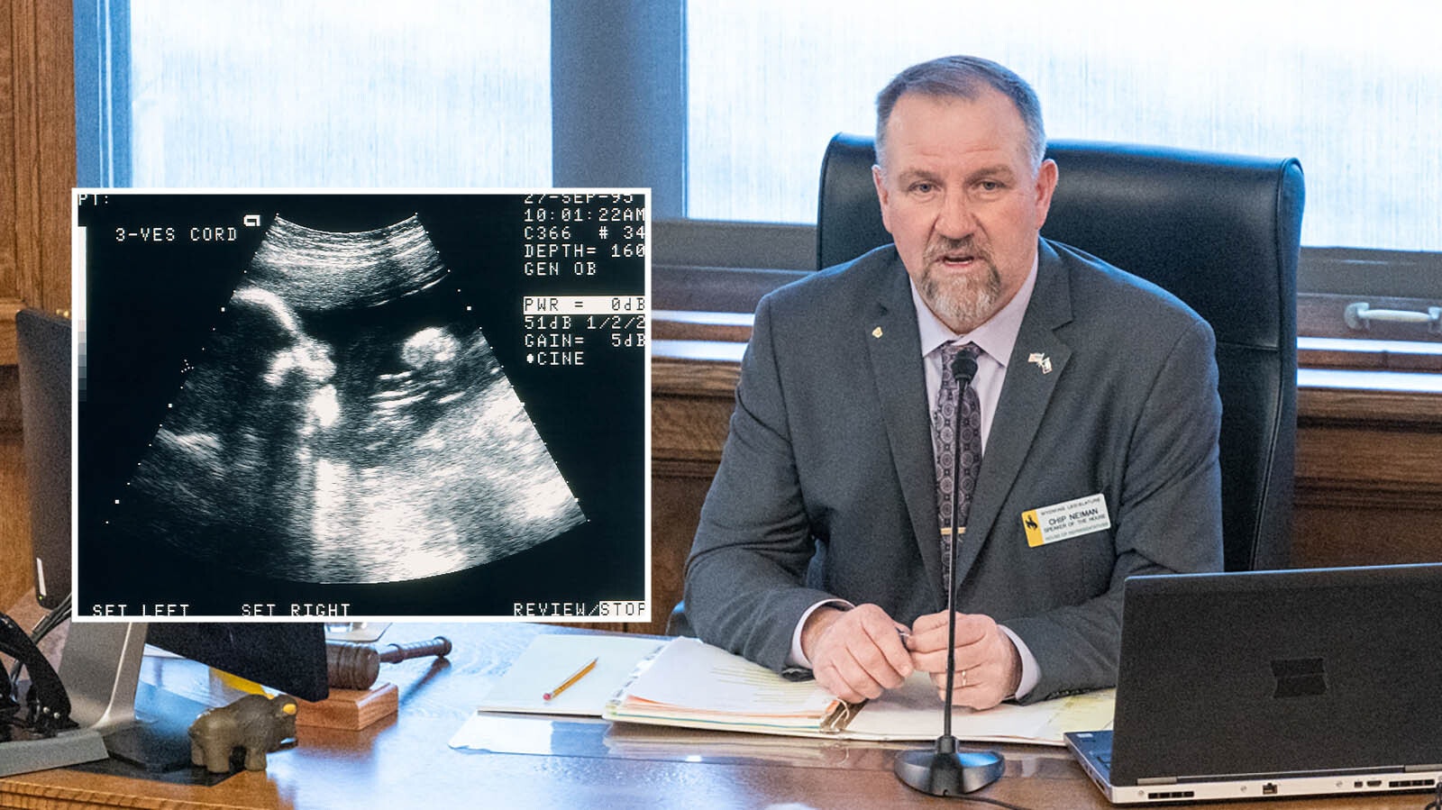 House Speaker Chip Neiman, R-Hulett, has proposed a bill requiring ultrasounds before women can get the abortion pill in Wyoming.