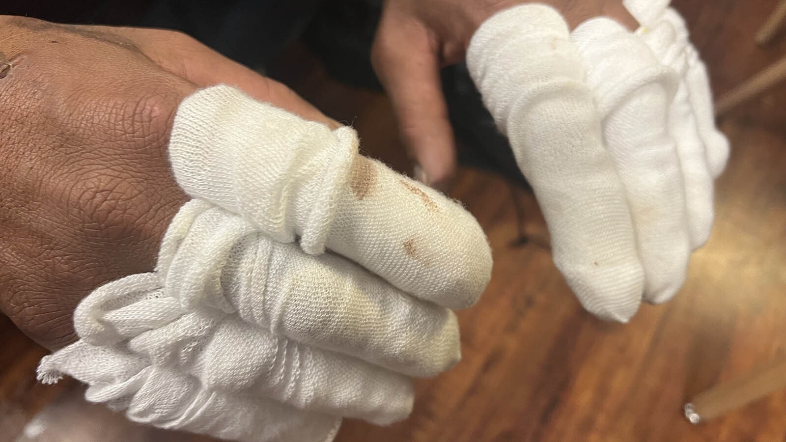 Some of the homeless who sought shelter at True Vine Community Church this past weekend showed up with various levels of frostbite. The severe cases were taken for medical attention.
