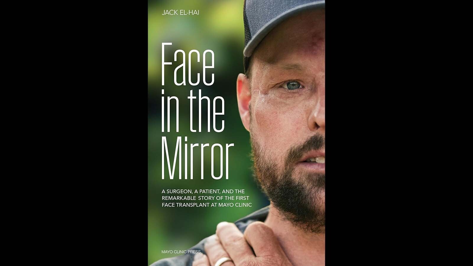 Jack El-Hai’s recently published book "Face in the Mirror: A Surgeon, a Patient, and the Remarkable Story of the First Face Transplant at Mayo Clinic.”