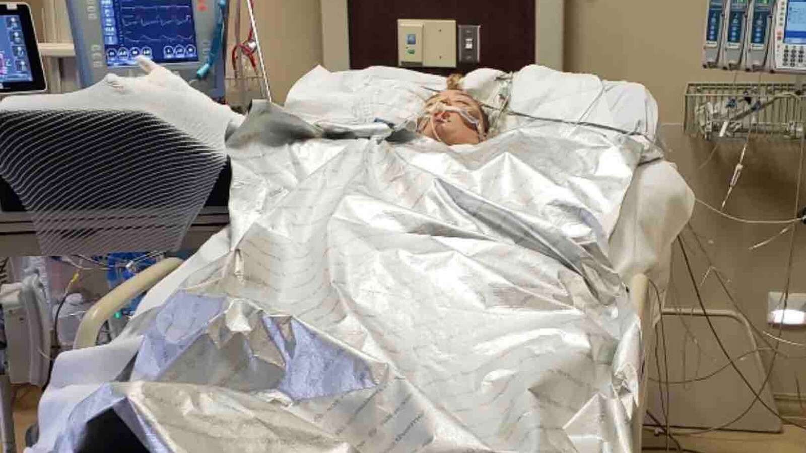 Girl burned at Yellowstone