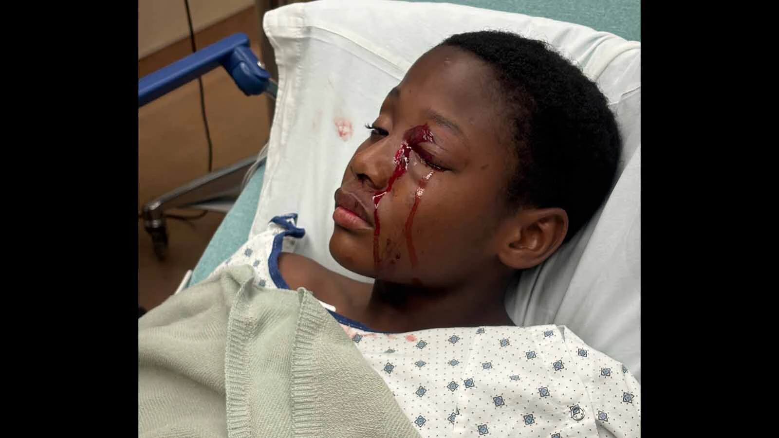 A Glenrock boy was airlifted to a Denver hospital on the Fourth of July after getting hit in the eye with an errant firework when it exploded in a crowd at a local park. A witness said he watched it "explode in the middle of the crowd of people.”
