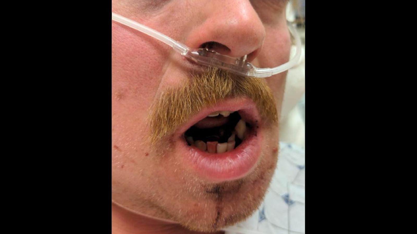 Hunter beaten 2 10 17 22