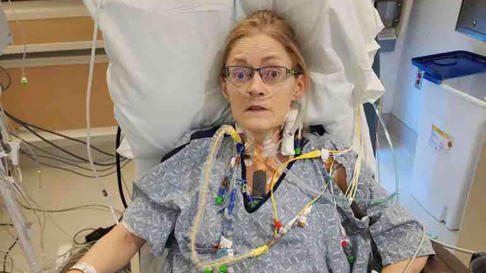 Jenn Green recovers after her third heart transplant in July 2023 at Cedars-Sinai Medical Center in California.
