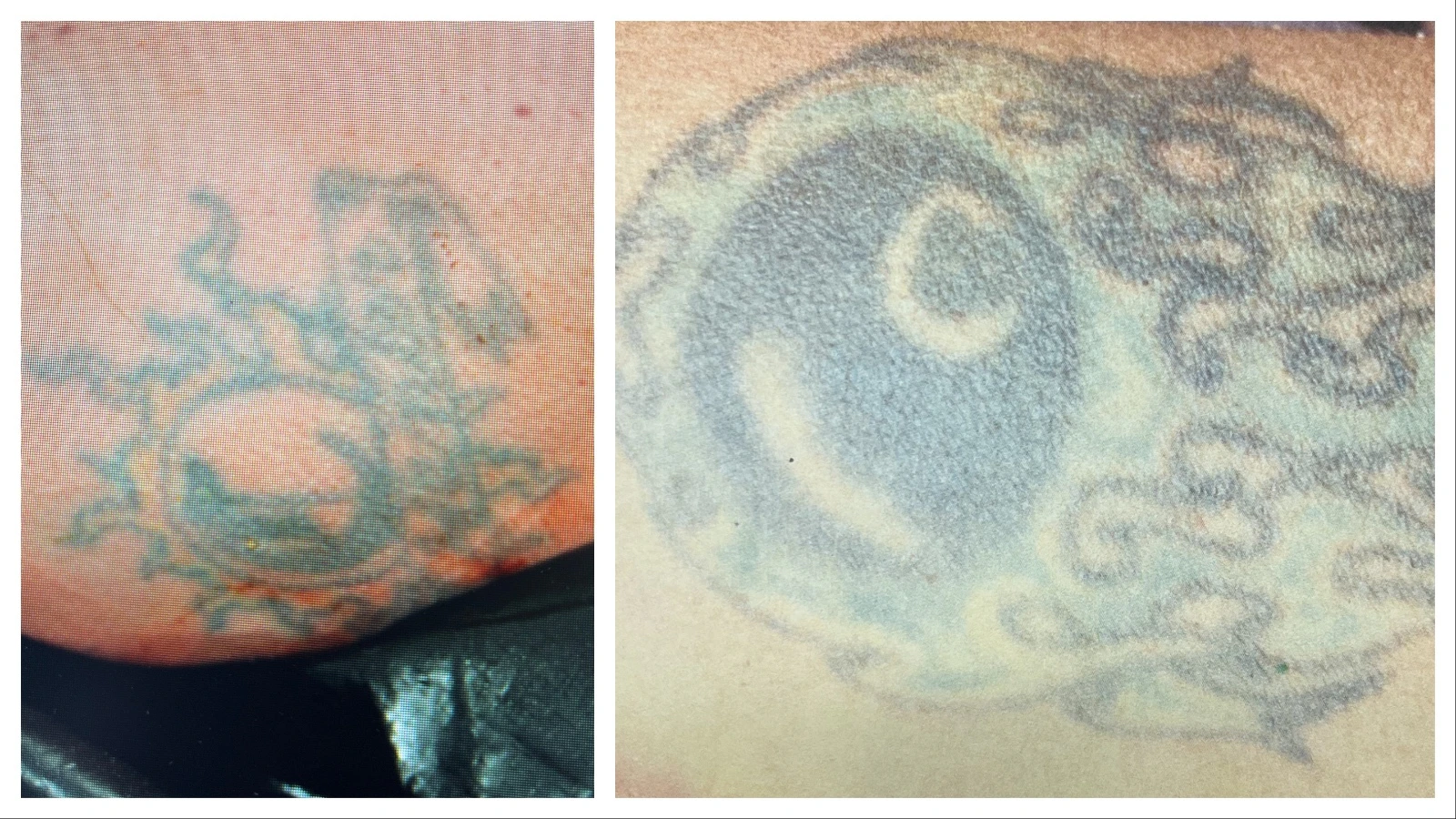 Distinctive tattoos on a John Doe found near Cheyenne in early June 2026.