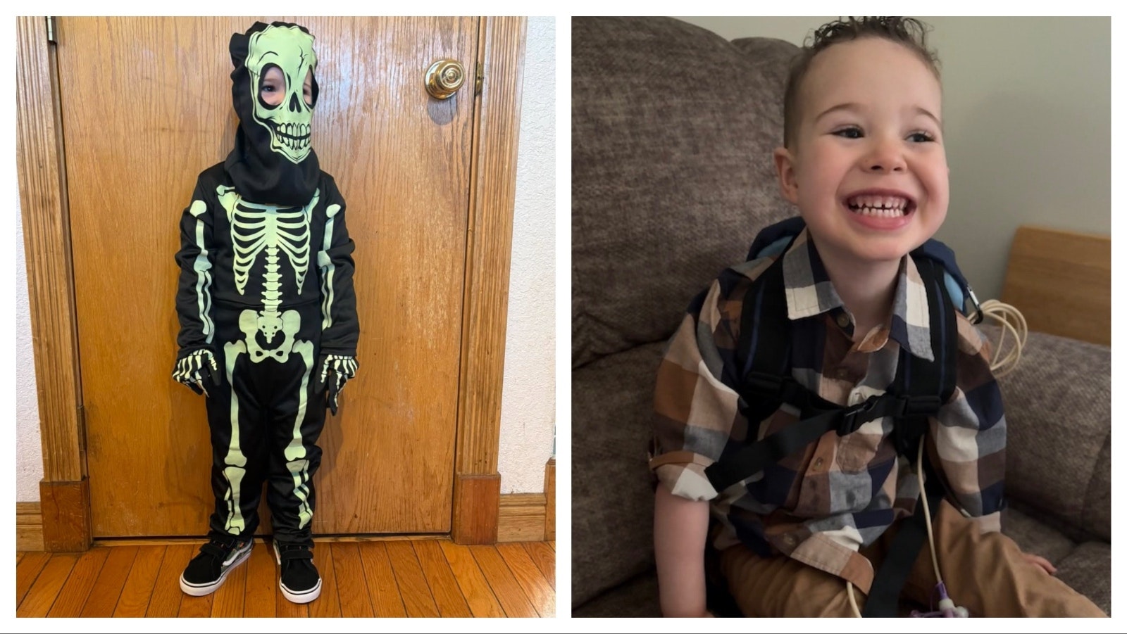 Kai Montoya in his skeleton outfit for Halloween. He was born with complex congenital heart disease and has his feeding tube placed when he was 21 days old.