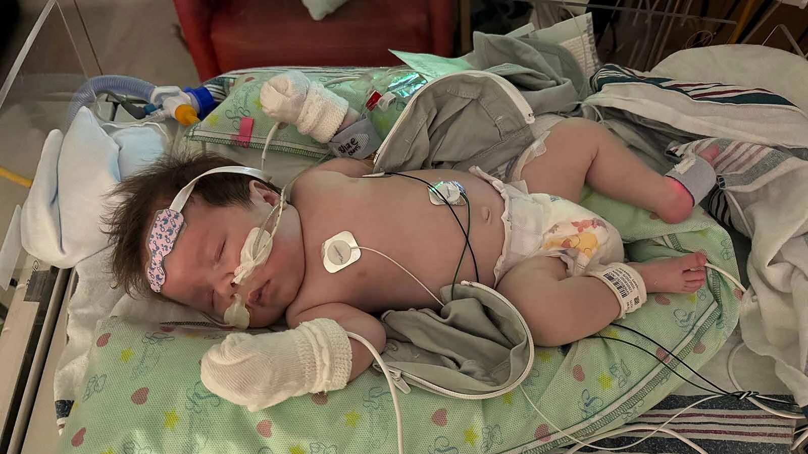 Nearly 3-month-old Lorelai Hockaday has spent almost her entire life in hospitals as doctors work to manage a rare lung disorder. The Casper baby is now in St. Louis waiting for a lung transplant.