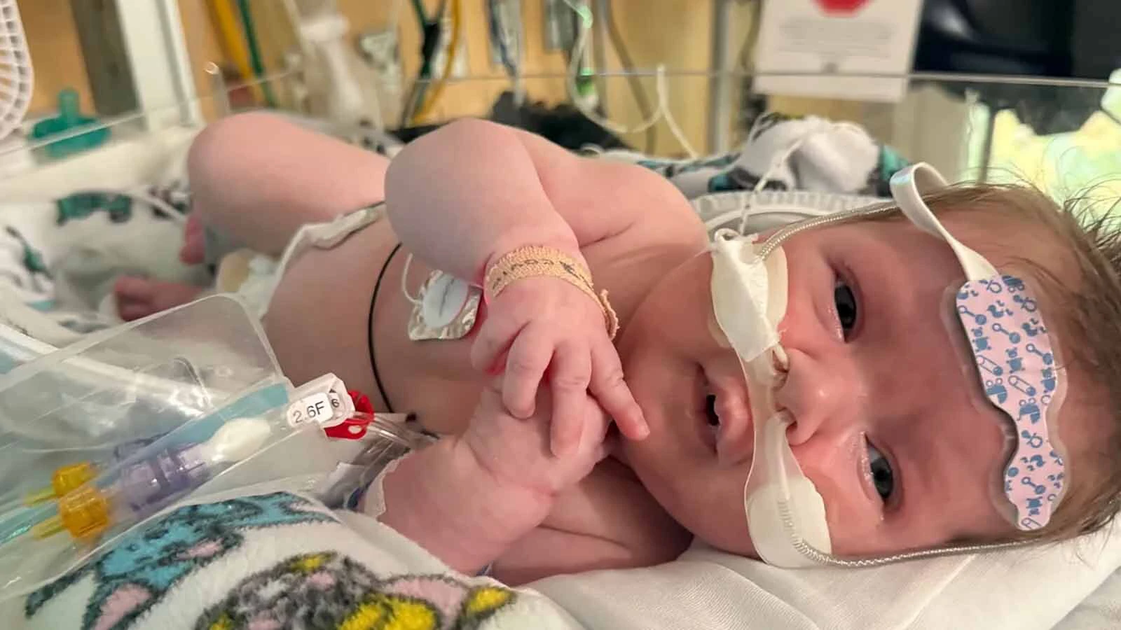 Nearly 3-month-old Lorelai Hockaday has spent almost her entire life in hospitals as doctors work to manage a rare lung disorder. The Casper baby is now in St. Louis waiting for a lung transplant.