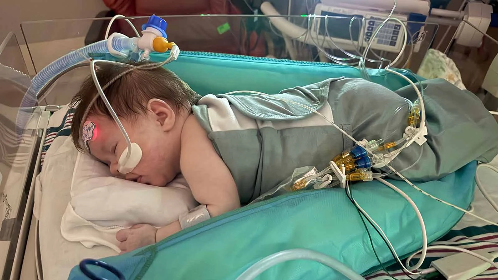 Nearly 3-month-old Lorelai Hockaday has spent almost her entire life in hospitals as doctors work to manage a rare lung disorder. The Casper baby is now in St. Louis waiting for a lung transplant.