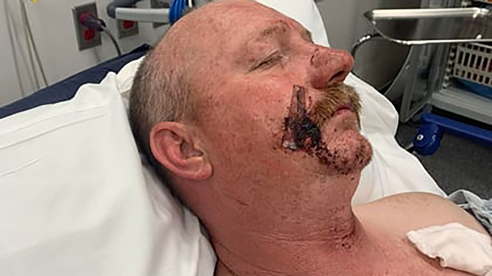 Moorcroft, Wyoming, resident Michael Hammond Jr. was picked up in Nebraska over the weekend after allegedly beating his wife. During the ordeal, she reportedly got her hands on a knife and stabbed him to end an hours-long beating.
