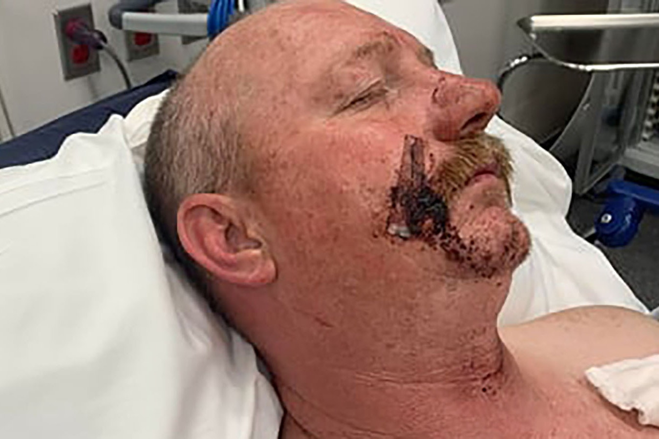 Moorcroft, Wyoming, resident Michael Hammond Jr. was picked up in Nebraska over the weekend after allegedly beating his wife. During the ordeal, she reportedly got her hands on a knife and stabbed him to end an hours-long beating.