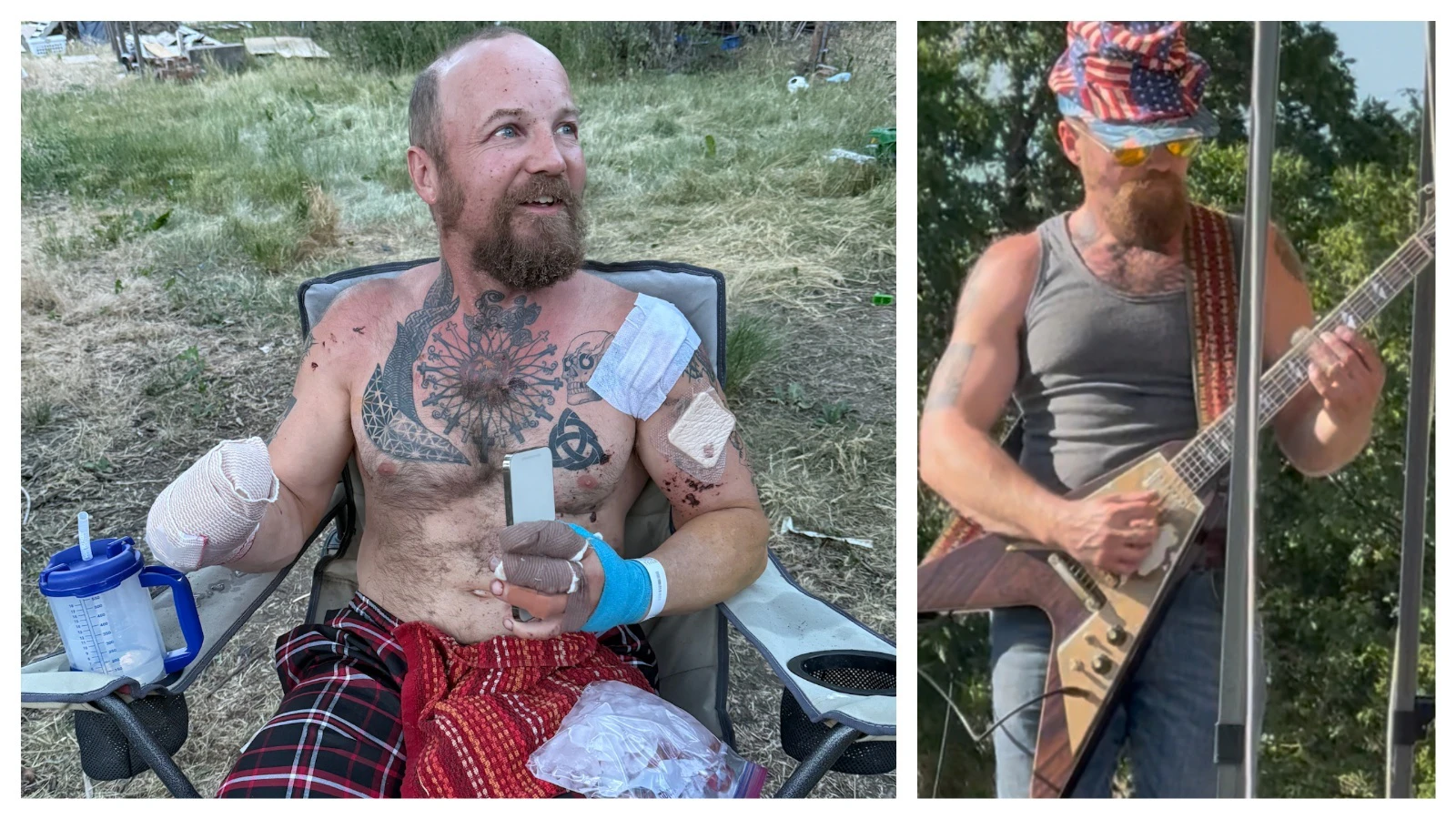 Matthew Lynch is recovering at home days after a Fourth of July firecracker explosion severely injured both of his hands (left). Matthew Lynch performs just hours before a firework exploded in his hands (right)
