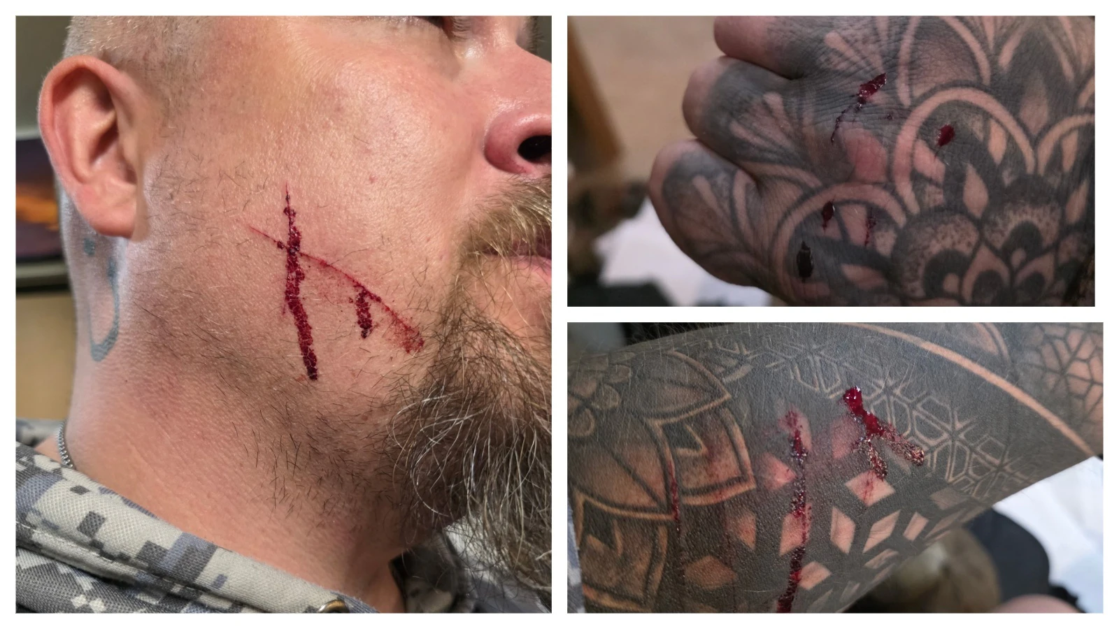 Adam Borkhus of Cody suffered numerous scratches while fighting a mountain lion to save his dog Saturday. He’s had to undergo precautionary medical treatments, including excruciating rabies shots.