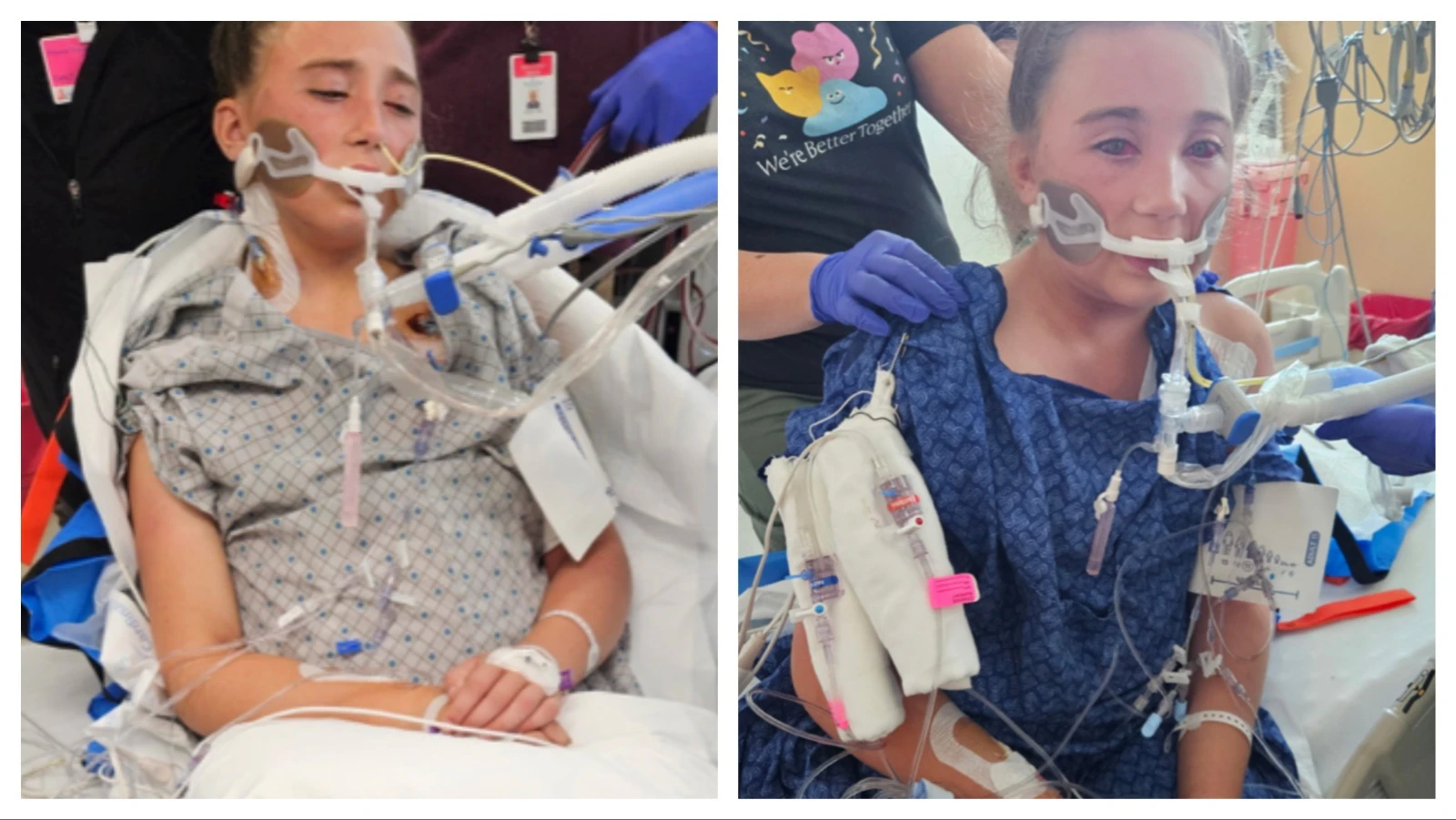 An 11-year-old Meridian, Idaho girl remains in critical condition following an Aug. 17 crash on Teton Pass that involved an RV she was riding in. A family friend said the girl’s 12th birthday is Saturday and she is communicating via sign language and a white board.