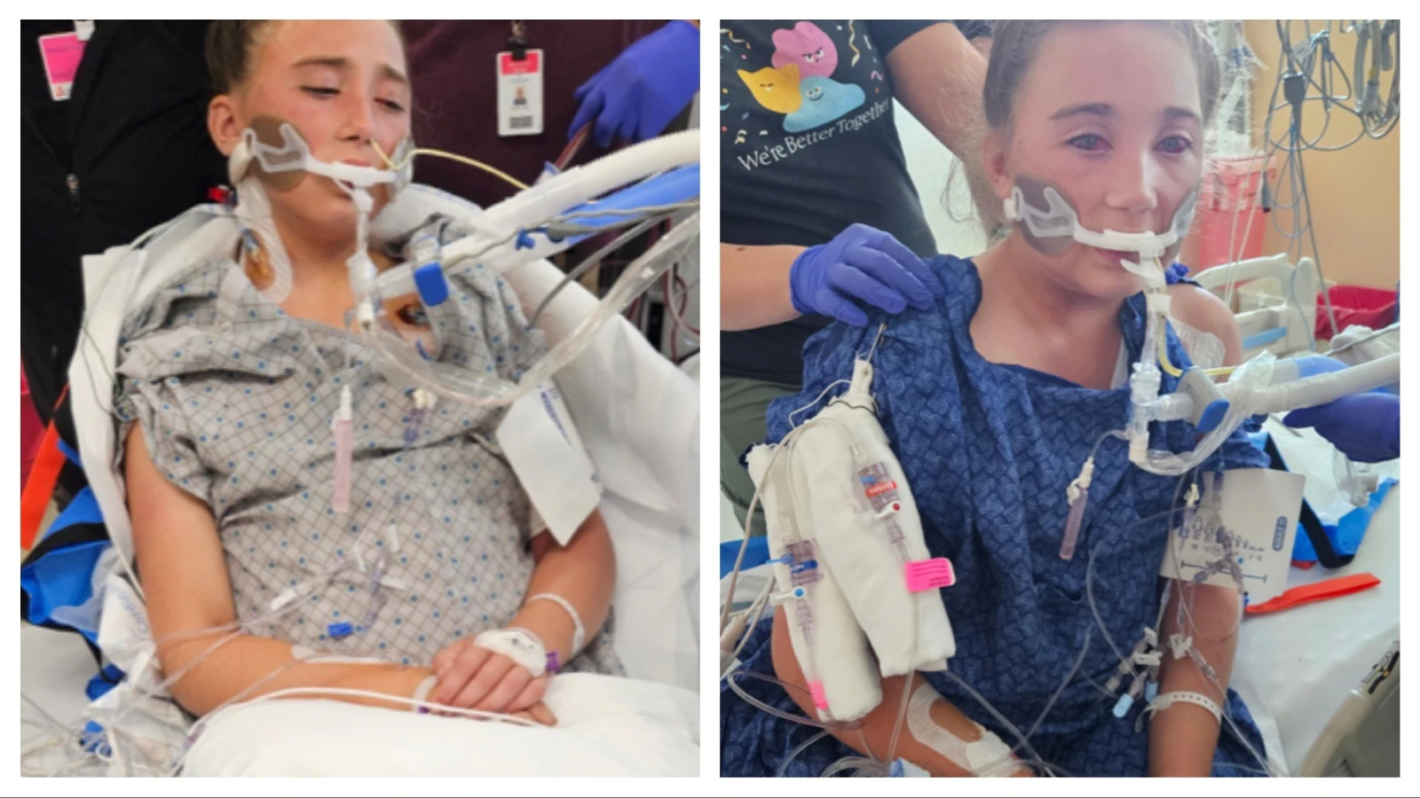 An 11-year-old Meridian, Idaho girl remains in critical condition following an Aug. 17 crash on Teton Pass that involved an RV she was riding in. A family friend said the girl’s 12th birthday is Saturday and she is communicating via sign language and a white board.
