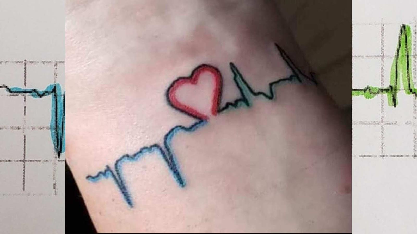 Casper couple Jason and Misty Wynia are grateful to mark another Valentine’s Day together. They are celebrating 16 years they would have missed had Jason not received a new heart in February 2010. Above is a tattoo Misty got representing Jason's heartbeat before and after his transplant.