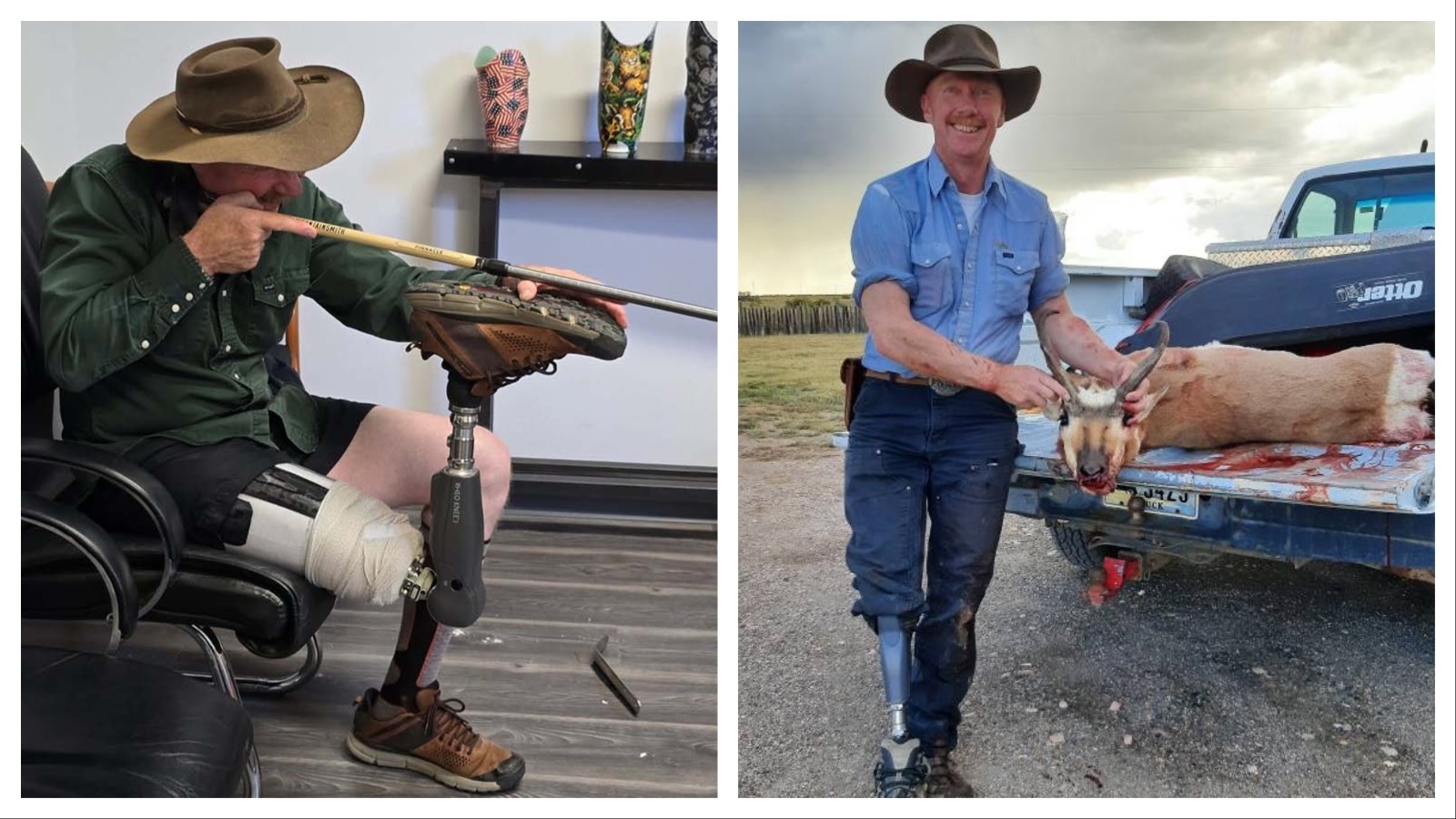 Randy Svalina of Laramie said he and his doctor started joking about designing his prosthetic leg to work as a hunting rifle rest. Now they’re seriously considering the idea.