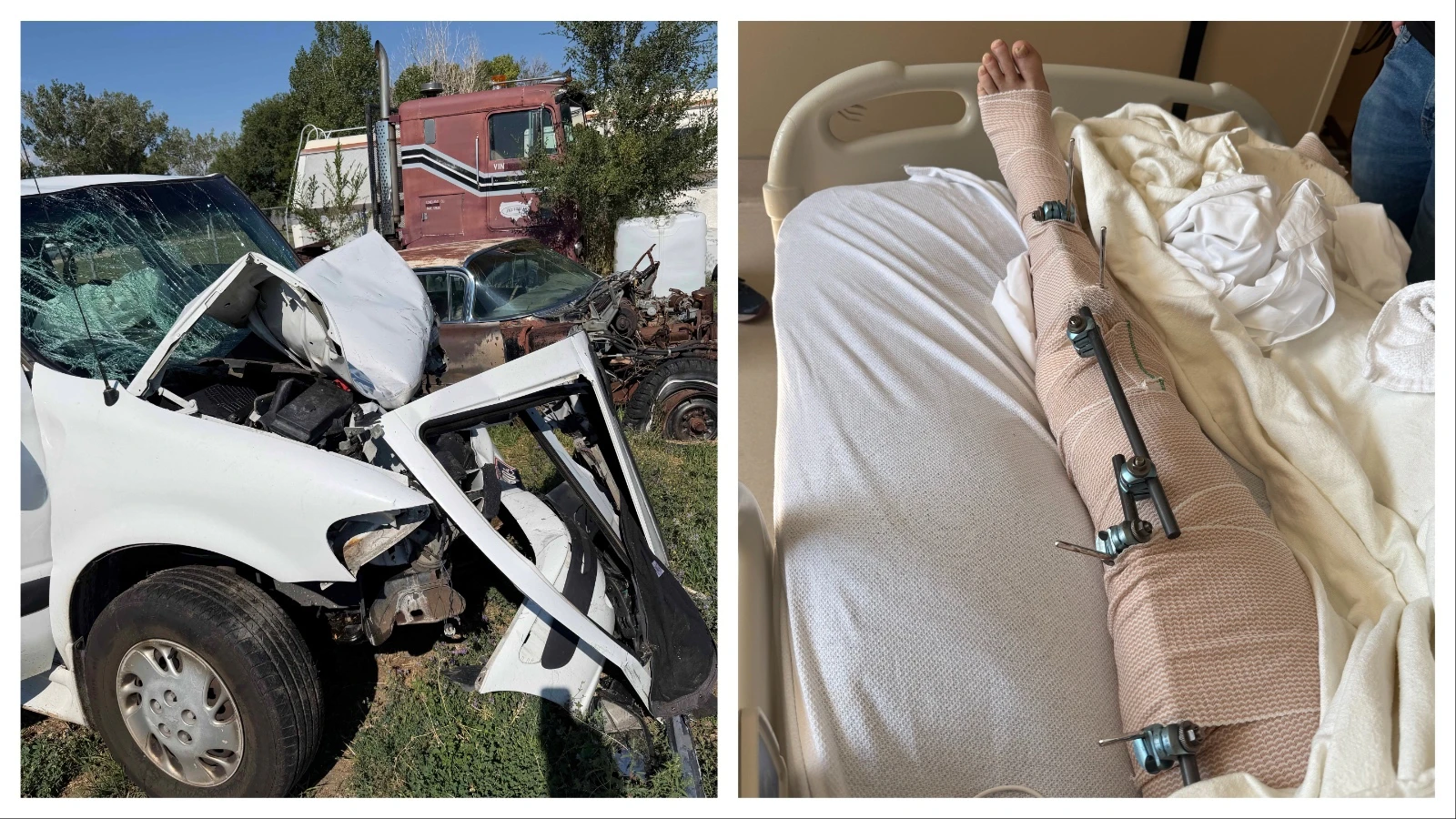 Roger Davis, a Casper pastor and mechanic, is facing a long recovery, laid up in a Denver-area hospital with a broken neck and hip, three broken ribs, a broken heel, shattered leg and mission teeth after a violent crash on Interstate 25 that nearly killed him.