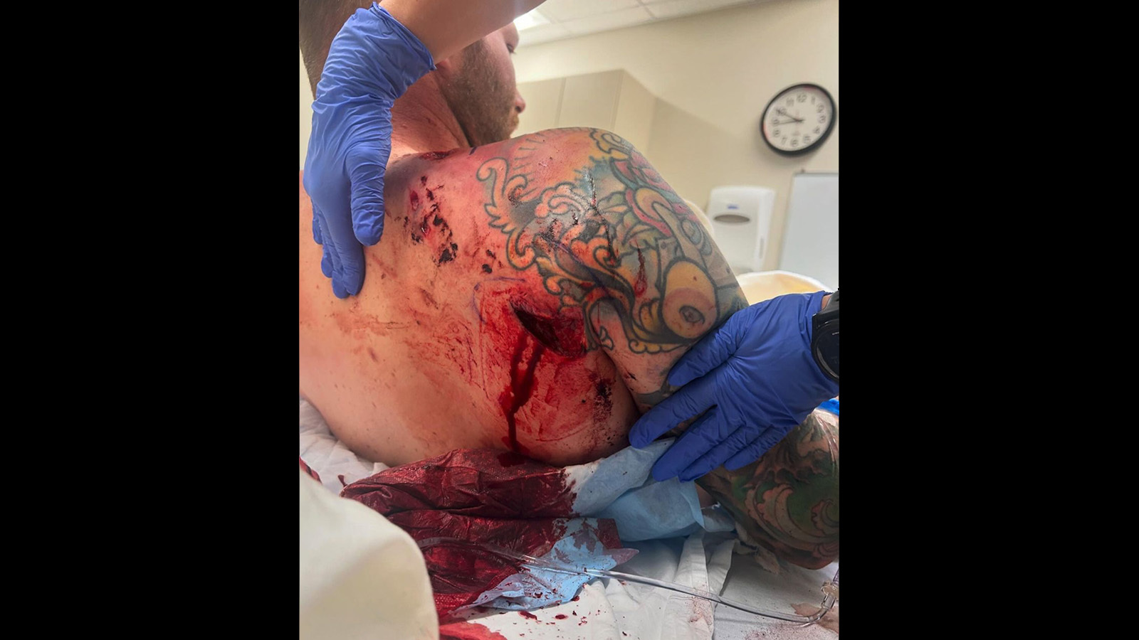 Grizzly Attack Survivor Says Ordeal Was Most Violent Experience Of His Life  | Cowboy State Daily, image size:1600x900