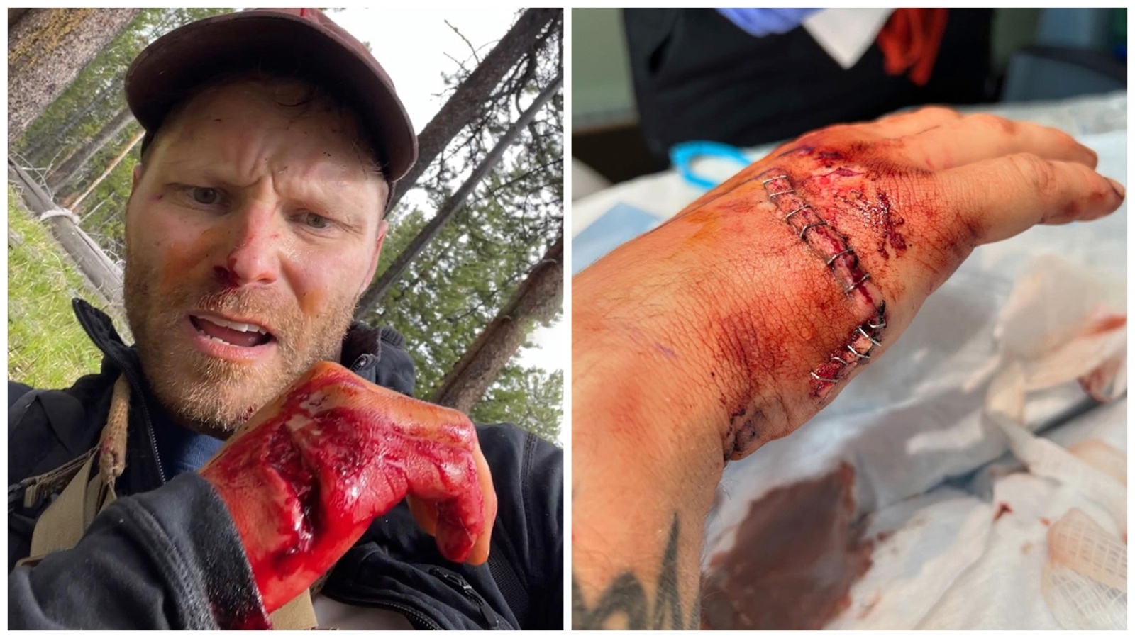 Grizzly Attack Survivor Says Ordeal Was Most Violent Experience Of His Life  | Cowboy State Daily, image size:1600x900