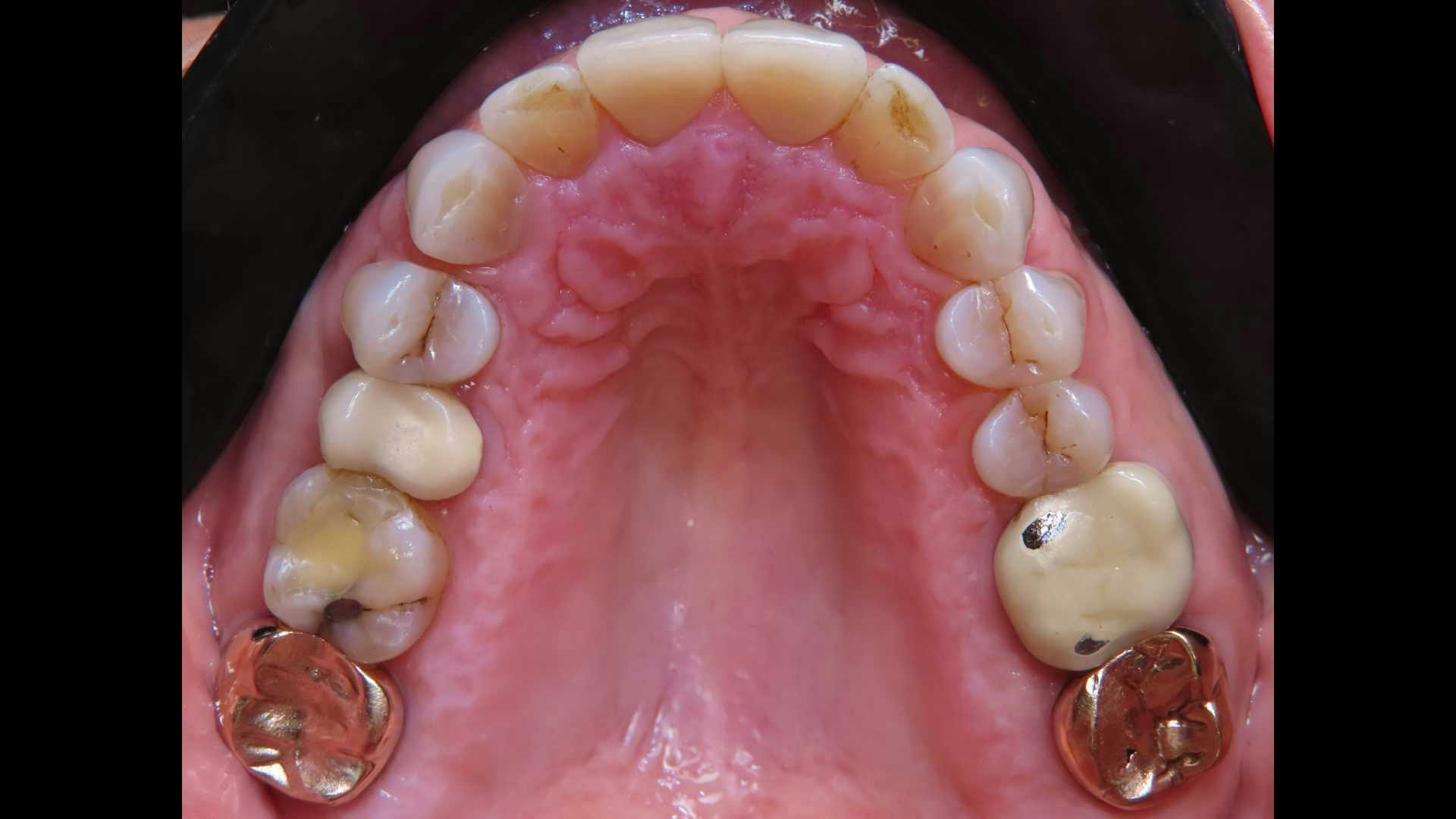 Before and after teeth images.
