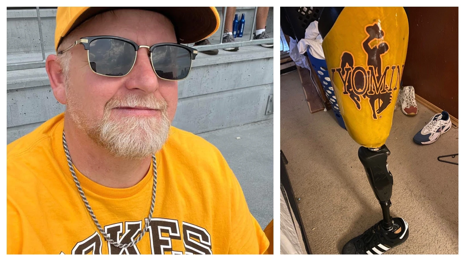Thor Stephenson Jr. thought he’d die after a shotgun blast destroyed his leg during a pheasant hunt in 2013. The Wyoming amputee still hunts, fishes and hikes on a custom $68,000 brown and gold Bucking Horse prosthetic he says symbolizes being cowboy tough. 