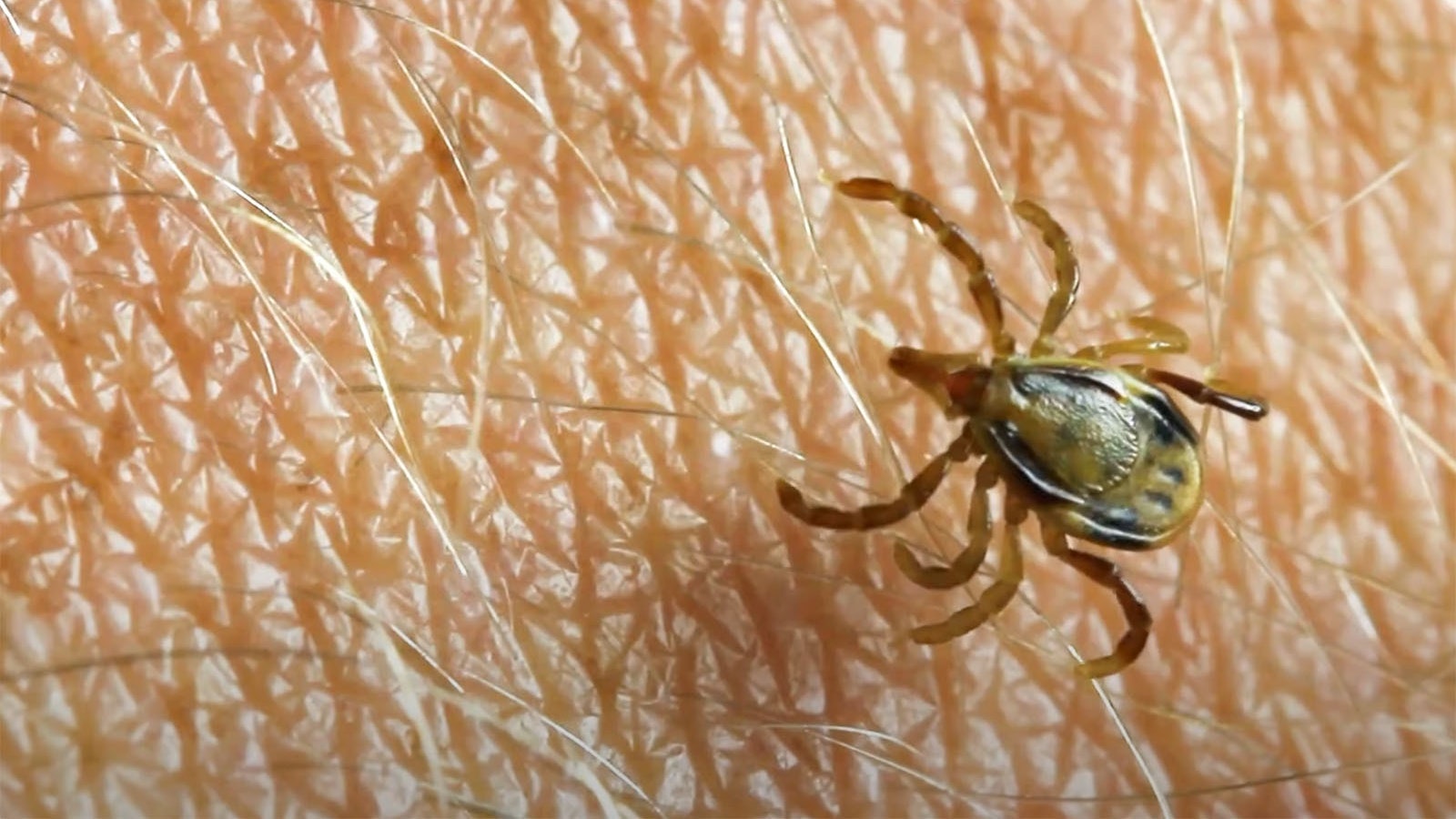 Tick on skin 7 10 23