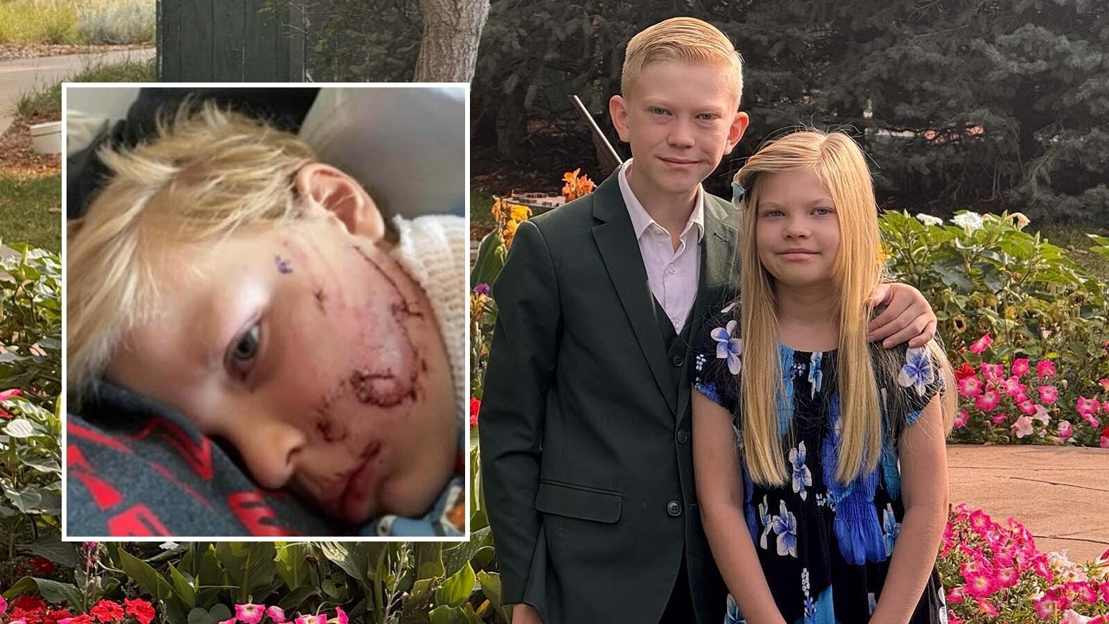 Leo Feller, 5, of Hurricane, Utah, suffered a brutal dog attack that left him with severe facial injuries. The attack is similar to one suffered by Bridger Walker of Cheyenne, who was then 6 and now 11, who had to get 90 stitches to sew up his face when he got between a vicious dog to save his younger sister. The Walker family has reached out to Leo's family with an offer of help and support.