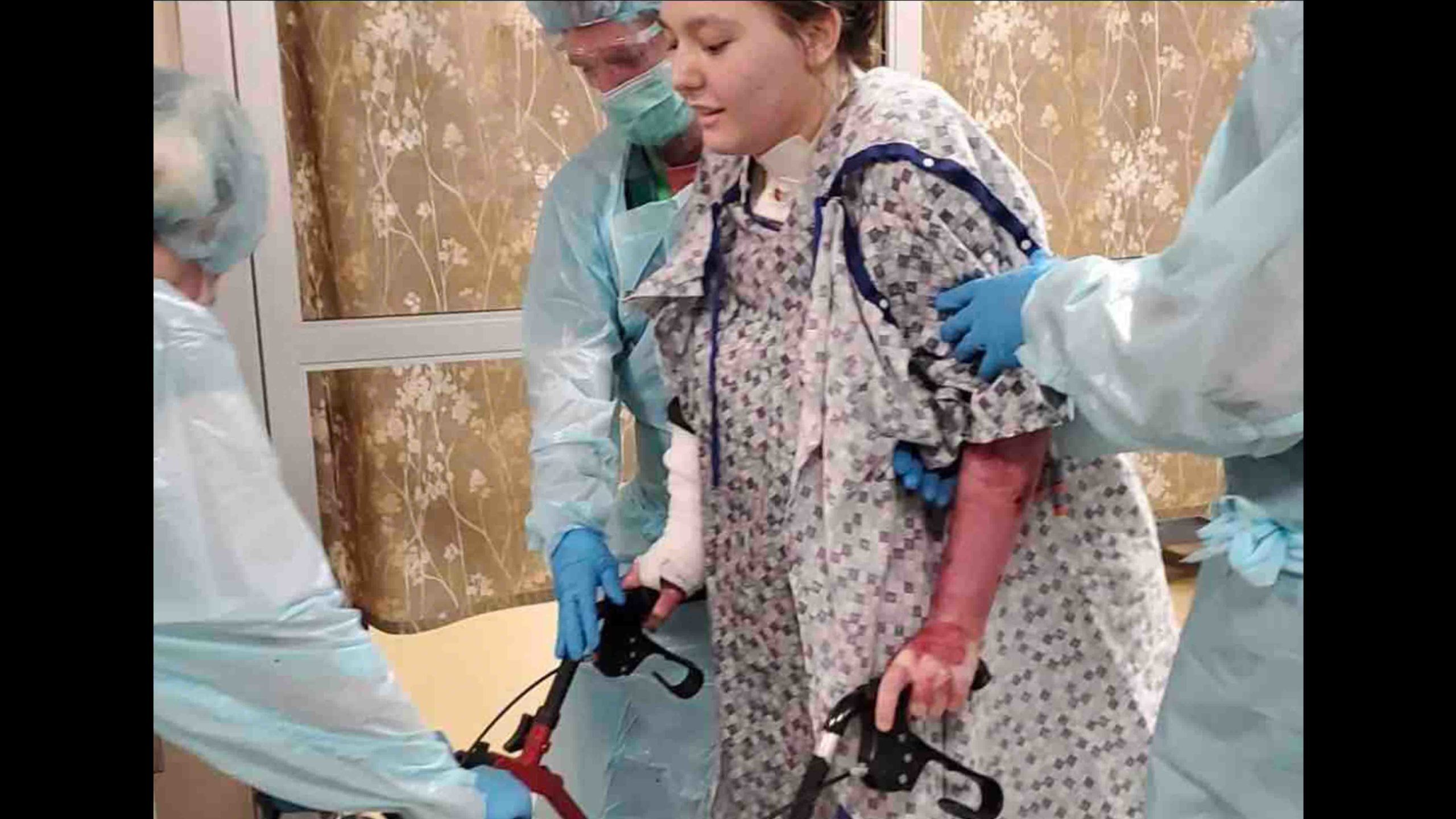 Burned woman walking 2 8 22 scaled