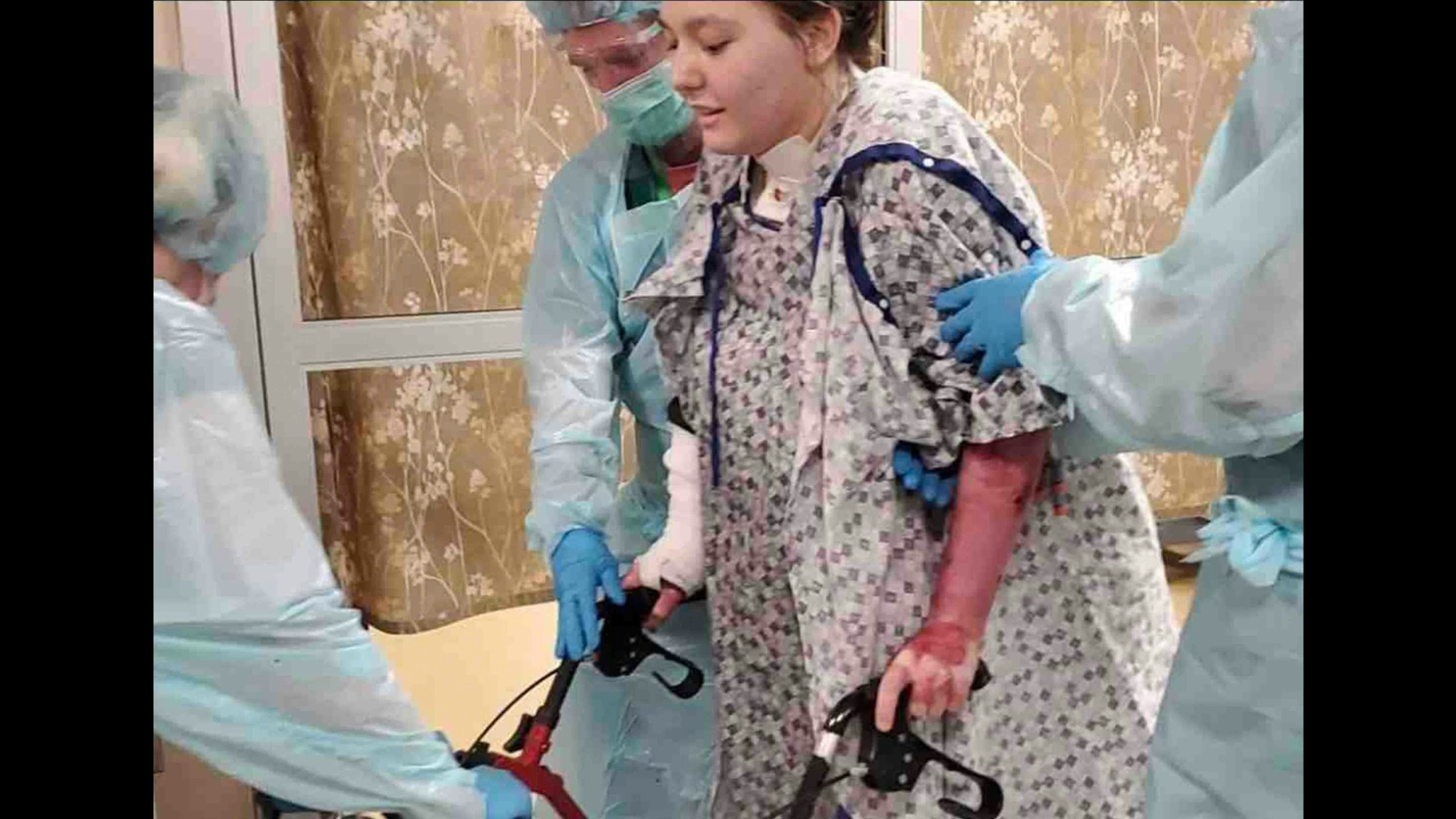 Burned woman walking 2 8 22 scaled