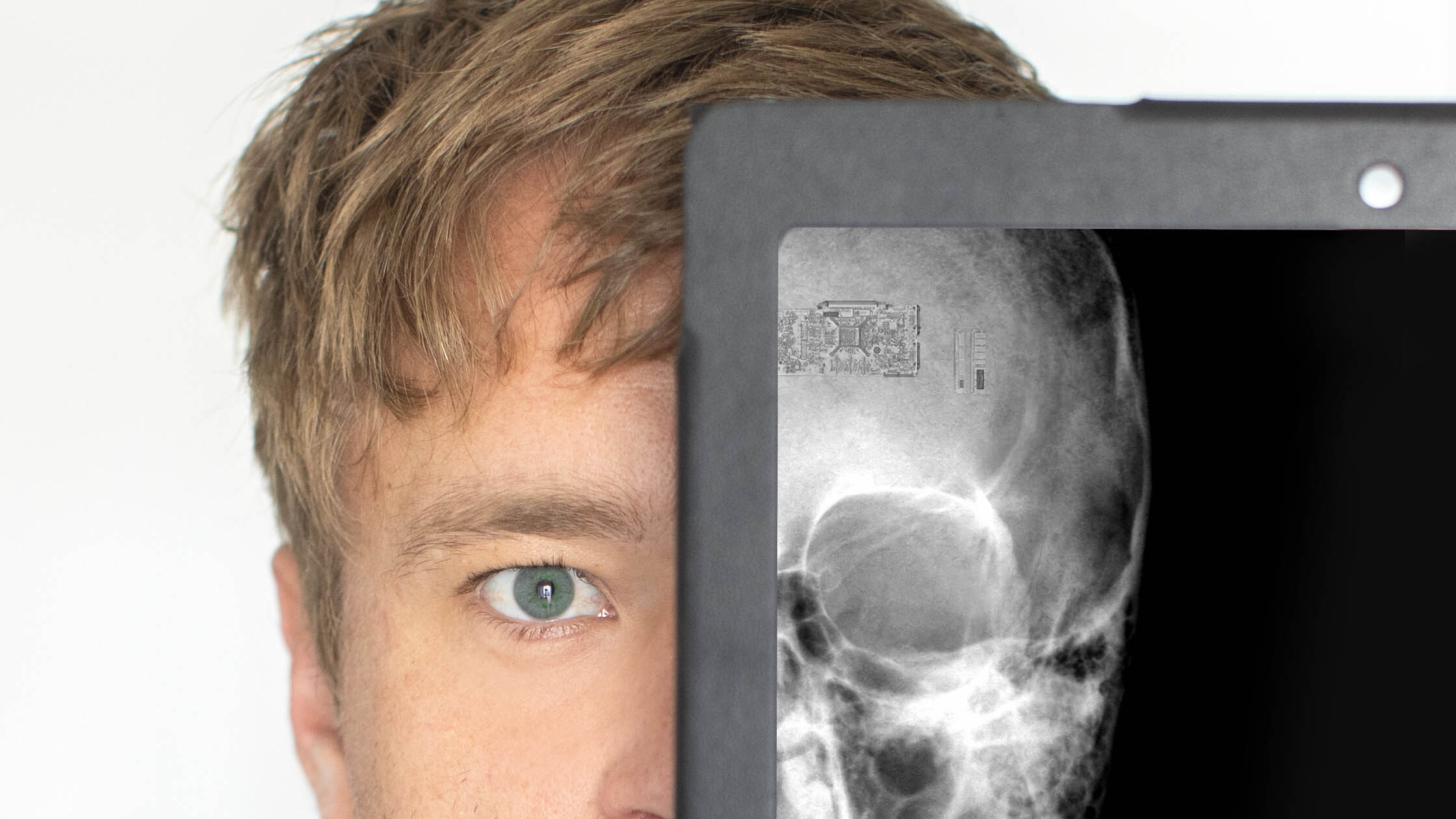 Microchip brain 3 2 23