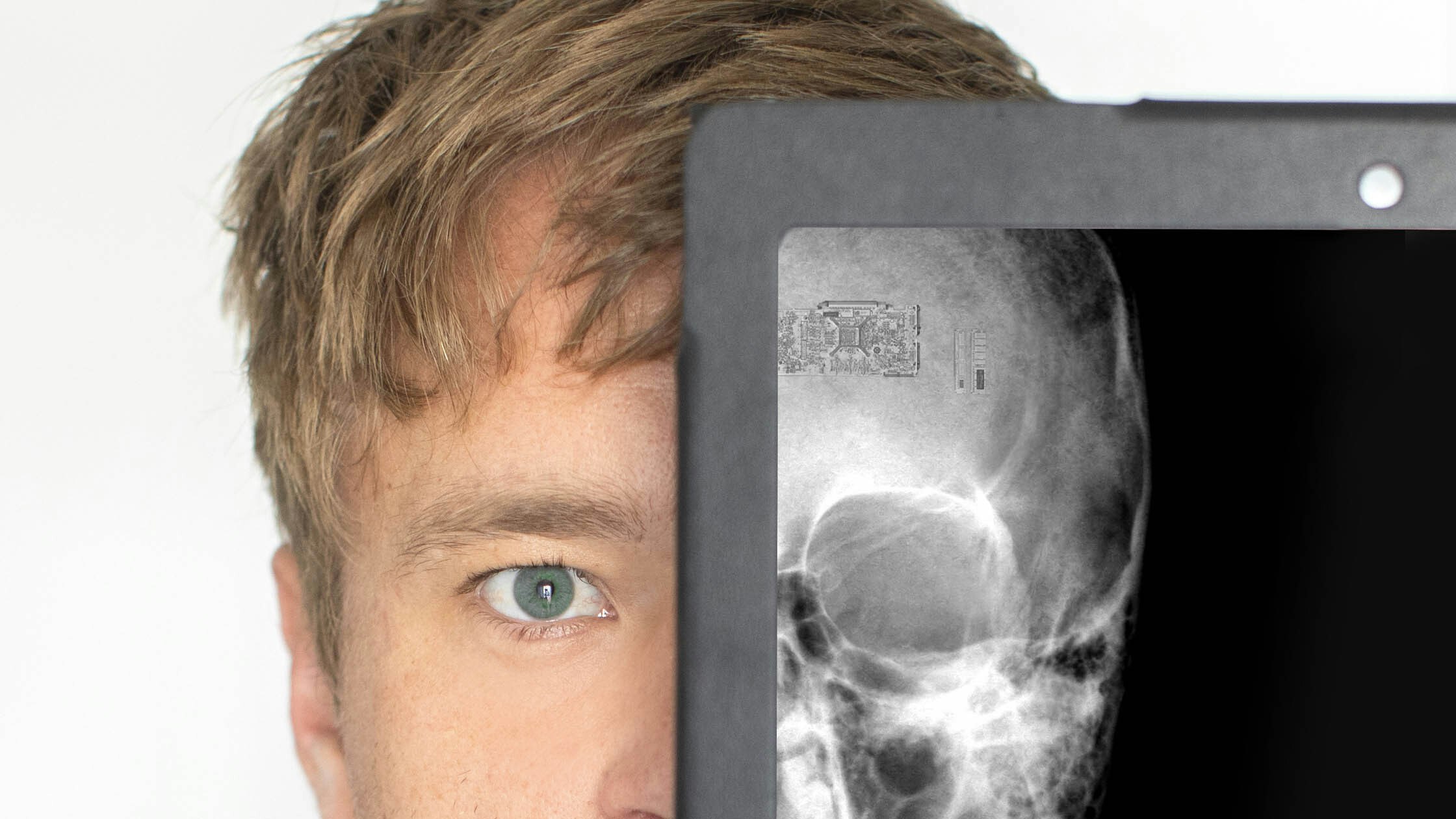 Microchip brain 3 2 23