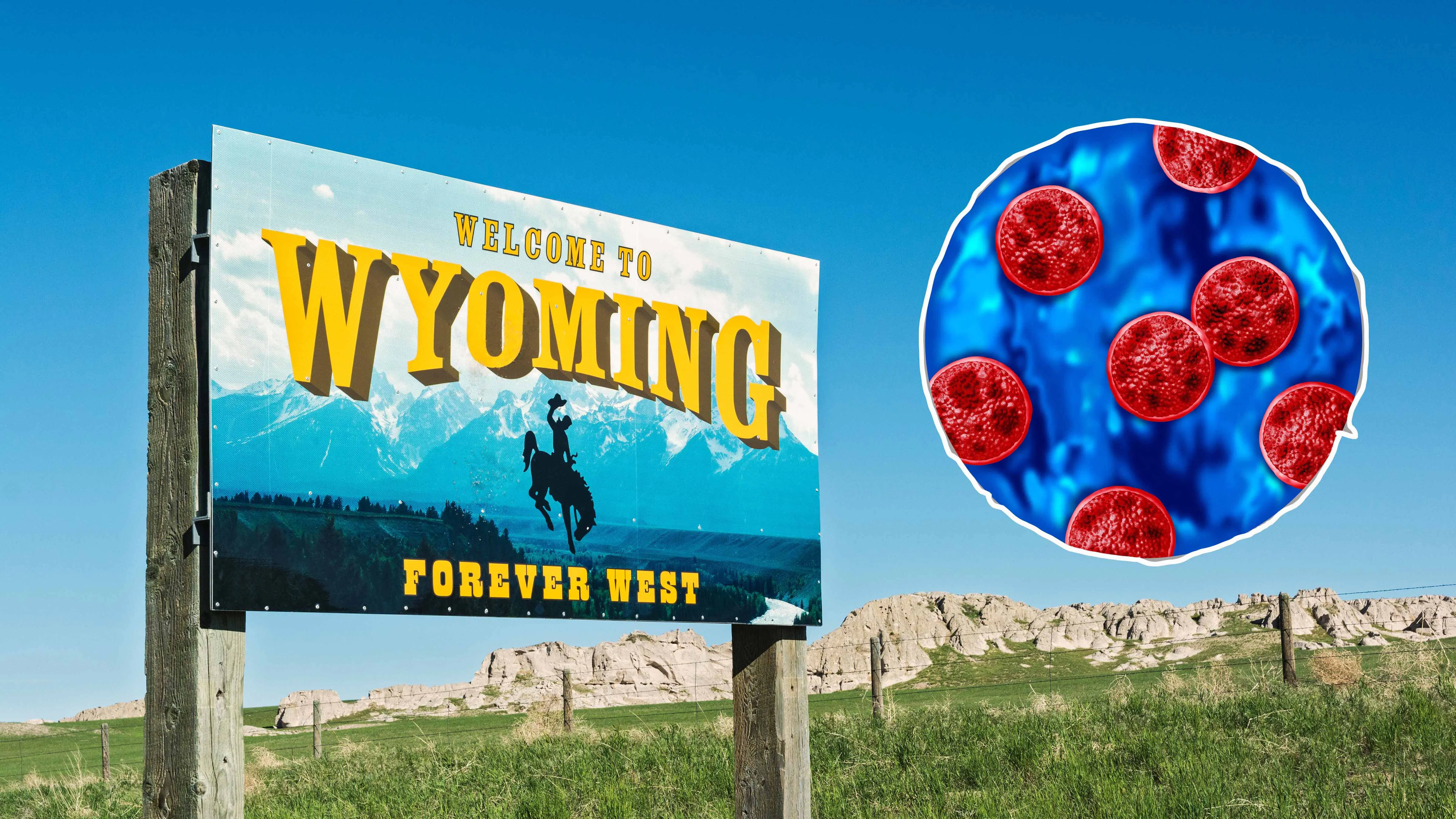 Wyoming has confirmed six cases of Cyclospora, a parasite that can cause weeks of explosive diarrhea, dehydration and weight loss.