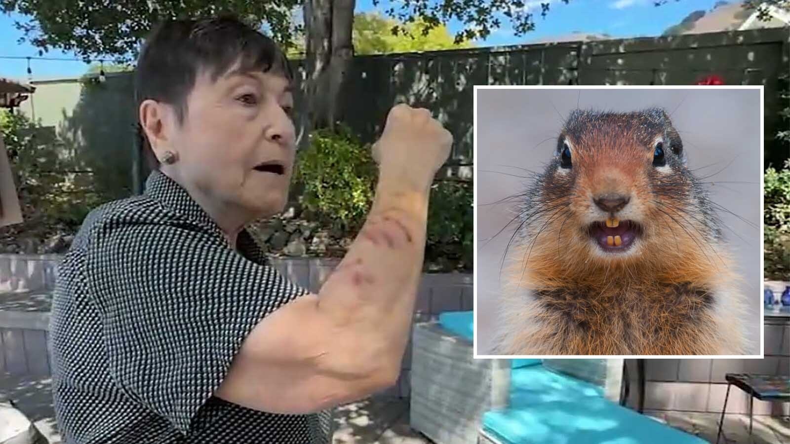 A squirrel in California’s San Fransico Bay area has gone rouge, attacking at least five people, sending two to the emergency room. Wyoming biologists say squirrels may look cute but can be meaner than people realize. Isabel Campoy suffered severe scratches to her arm.